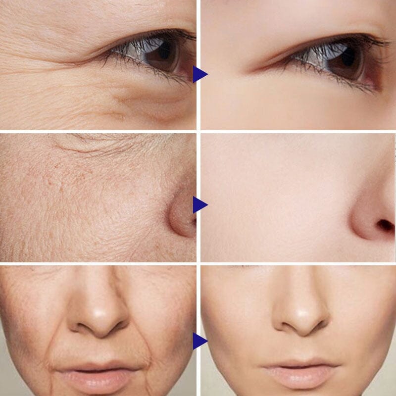 Sérum Retinol Anti-Rugas Combate Linhas De Expressão, olheiras, Flacidez e Viço